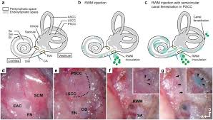 In this image, you will find the anterior/superior canal, utricle, vestibulocochlear nerve, cochlea, saccule, lateral/horizontal canal, posterior/inferior canal in it. Enhanced Viral Mediated Cochlear Gene Delivery In Adult Mice By Combining Canal Fenestration With Round Window Membrane Inoculation Scientific Reports