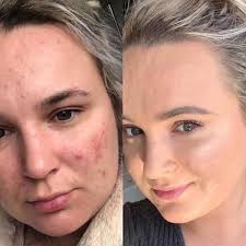 All foundation samples available Ideal £1, Blur £1 and Alaya £1.85