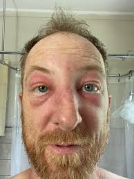 Best way to refill internal feeders like this?