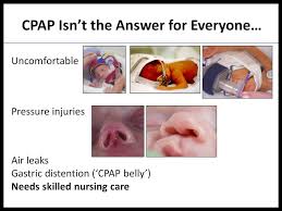 She is interested in all aspects of general practice. Hot Topics In Neonatology Neonatal Respiratory Symposium Nasal High Flow Therapy Evidence Base For Preterm Infants Dr Louise Owen Md Ppt Download