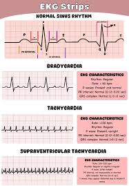 Image result for Electrocardiogram Validity