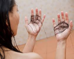 Old hair loss standard the old standard for monitoring hair loss was that normal hair loss amounted to what they found was that on average only about 10 hairs are lost per day in a normal, healthy male 2. 7 Ways To Tell If You Re Losing Too Much Hair