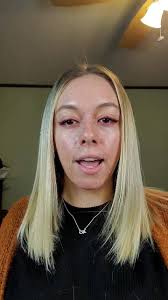 Image Skincare Perfection Lift FORTE Peel Update.