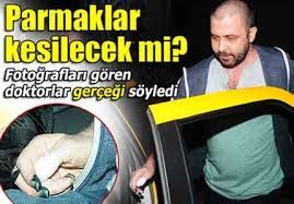 Görülebilen bir sorundan dolayı sağ el parmakları moraran i̇şler'e ameliyat olması gerektiğini söyledi. Nejat Isler In Parmagi Kesilecek Mi Haber Kibris