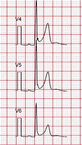 Image result for J Wave