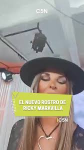 Ricky Maravilla sorprendió con una cirugía estética y se viralizó