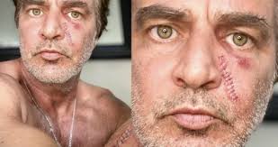 The Young and the Restless Spoilers: John Enos (ex-Bobby Marsino) Shares  Melanoma Scare