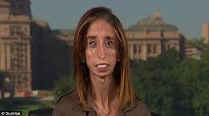 In the current world that we are living in, there are very many people that are considered to be very attractive yet they are very ugly, there are some of the factors that are considered by the people that are judging them so that they can be sure that those people can be said to … How World S Ugliest Woman Lizzie Velasquez Fought Back Against The Bullies Daily Mail Online