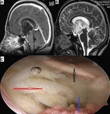 The Pan African Medical Journal Image Quiz