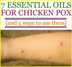 Pin On Essential Oil Recipes