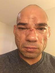 Evangelista Cyborg Diz Que Nao Pensa Em Parar Volto A Lutar Em Seis Meses Combate Globoesporte Com
