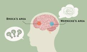 Image result for Aphasia