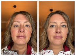 Review of Lightweight Skin Tint with Great Coverage