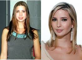 Pin On Celebrity Plastic Surgery