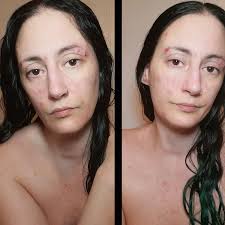 Though my upper body has seen better days, it's not as bad as when I met  @karenpickett.lmft