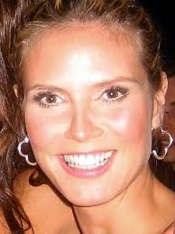 25+ Celebrities With Strabismus