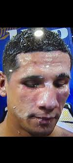 Tonight, that kid from San Juan, Puerto Rico fights for a world title 🥲