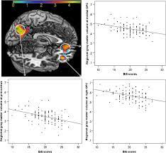 Individual Differences In The Behavioral Inhibition System Are Associated With Orbitofrontal Cortex And Precuneus Gray Matter Volume Springerlink
