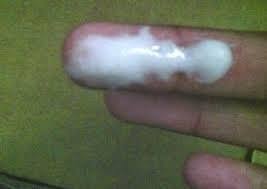 We did not find results for: Penyebab Keputihan Berbau Busuk Serta Cara Mengobati Secara Alami Obat Keputihan