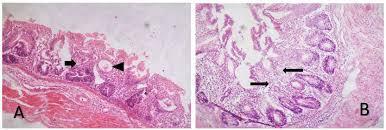 Image result for Lannea schimperi