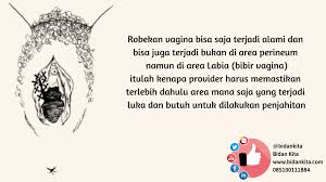 Luka jahitan bersalin cenderung mengambil antara 2 dan 4 minggu untuk sembuh, tetapi semua orang adalah berbeza, dan sesetengah orang mungkin memerlukan masa yang lebih lama. Sembuhkan Luka Jahitan Perineum Dengan Cepat Page 2 Of 4 Bidan Kita