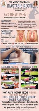 Pin On Diastasis