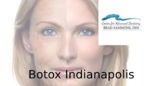 Best Botox Indianapolis Trusts to Reduce Wrinkles and Sweating
