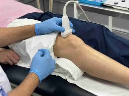 Image result for Prepatellar Bursa Injection