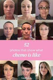 Chemotherapy may cause hair loss all over your body — not just on your scalp.eyelash, eyebrow, armpit, pubic and hair loss is a distressing symptom of chemo, one many people wonder if they can prevent. My Chemotherapy Diary 52 Photos Of Hair Loss And Recovery Cancer Hair Loss Hair Loss Treatment Treat Hair Loss