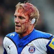 Is rugby a dangerous sport? Rugby Injuries Rugbyinjuries Twitter
