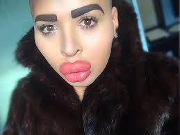 Man who inflated lips to look like Kim Kardashian has pout reduced