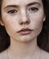 How to look good with freckles
