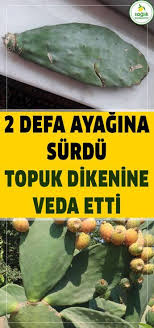 Topuk Dikenine Karsi Denenmis Dogal Yontem Dogal Saglik Topuk Dikeni Dogal