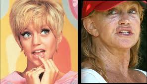 For Zoe (Befores and afters for the New Year) — Josh and Shelly Buck