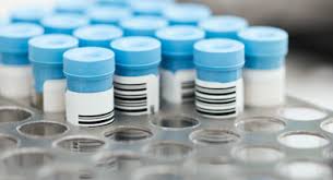 Just like in type 1 and type unlike other types of diabetes, gestational diabetes isn't permanent. Everything You Need To Know About Gestational Diabetes