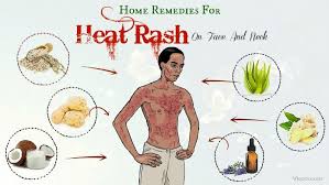 Pin On Home Remedies