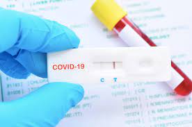 Samples for diagnostic tests are typically collected with a nasal or throat swab. London Harley Street Practice Covid 19 Testing