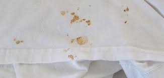 إزالة بقع الصدأ عن الملابس البيضاء حياتك