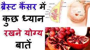ब्रेस्ट कैंसर (स्तन कैंसर) से बचाव (breast cancer prevention in hindi). Treatment Of Breast Cancer In Hindi Munir4