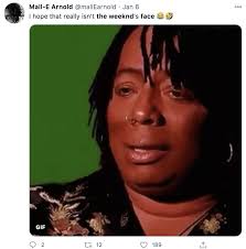 A plastic surgery loan is one way — but not the only way — to pay for cosmetic work. The Weeknd S Plastic Surgery All You Need To Know