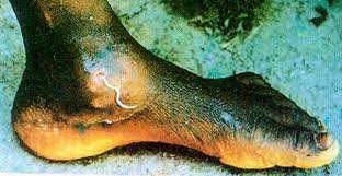 Parasite Meaning In Marathi Toxoplasmosis