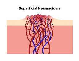 Hemangioma In Dogs What Is It And What To Do About It Top Dog Tips