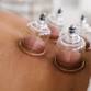 Cupping Massage event image