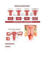 If you have any of these signs, see your doctor. Cancer Of The Cervix Docx Cervical Of The Cervix Nurnih Banquerig Caregiver Cervical Cancer Cervical Cancer Begins In The Cells Of The Cervix When