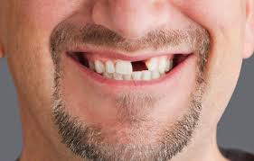 A lot of people use this search to find a dentist in a new area that they have moved to or are unfamiliar with. Emergency Dental Care Dental Emergencies Western Dental