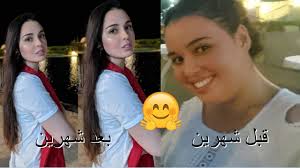 Check spelling or type a new query. Ø´Ù‡ÙŠØ±Ø© Ù‚Ø¨Ù„ ÙˆØ¨Ø¹Ø¯ Ø®Ø³Ø§Ø±Ø© Ø§Ù„ÙˆØ²Ù† ÙˆØ§Ù„Ø±Ø´Ø§Ù‚Ø© Ù…Ø§ Ù‡ÙŠ Ù…Ø±Ø§Ø­Ù„ ÙÙ‚Ø¯Ø§Ù† Ø§Ù„ÙˆØ²Ù† Ø®Ù„Ø§Ù„ Ø§Ù„Ø±Ø¬ÙŠÙ…