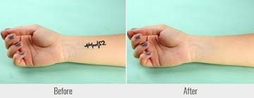 Download remove my tat and enjoy it on your iphone, ipad, and ipod touch. How To Remove A Tattoo In Photoshop