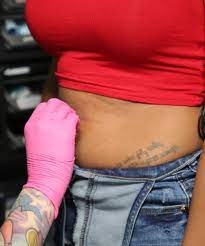 Common reasons patients undergo umbilicoplasty include: Belly Button Piercing Scar Experience Review Tutorial
