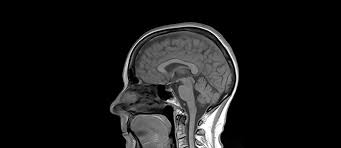 Anatomiequerschnitte auf der grundlage medizinischer bildgebung (scanner, mrt, röntgenaufnahmen) und makroskopischer anatomie ausgehend von medizinischen abbildungen. Mvz Diagnostikzentrum Radiologie Marburg Mrt Kopf