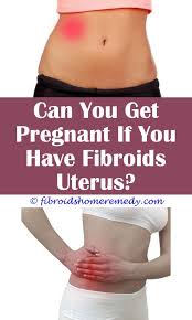 Pin On Fibroid Belly Pictures